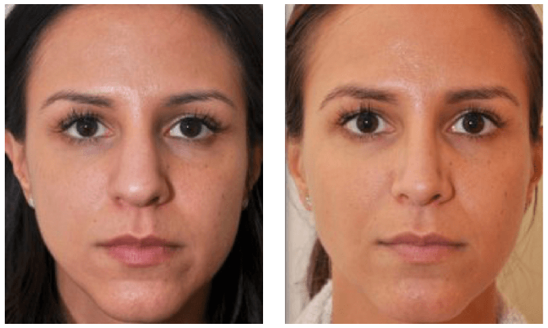 Nyc facial plastic surgery