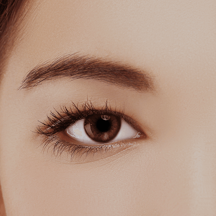 Eyelid Surgery Woman